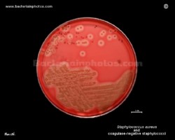colonies of staphylococci on CAP blood agar plate