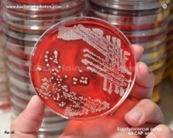 a hand holding agar plate with s.aureus