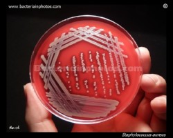 staph in petri dish
