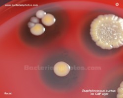 yellow bacterial colony surrounded by hemolysis on blood agar