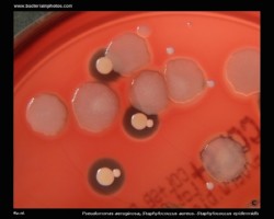 s.aureus compared with s.epidermidis and p.aeruginosa