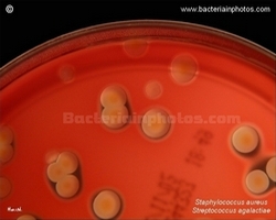 s.aureus and s.agalactiae