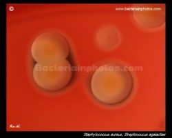 s.aureus yellow colonies, colony close-up