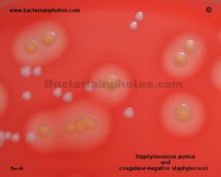 s.aureus colonies in comparison with staphylococcus epidermidis