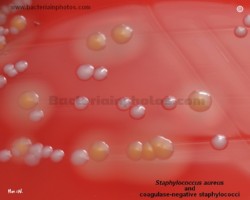 s.epidermidis and s.aureus colony morphology