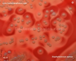 effect of various hemolysins on erythrocytes