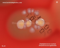 staph and strep colony comparison