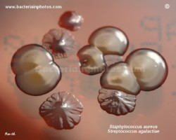 golden staph and atypical strep colony morphology