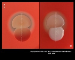 colony of golden staph and staph epidermidis
