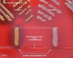 yellow pigmented and nonpigmented strain of s.aureus