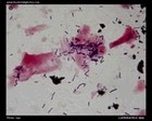 lactobacilli in vaginal smear