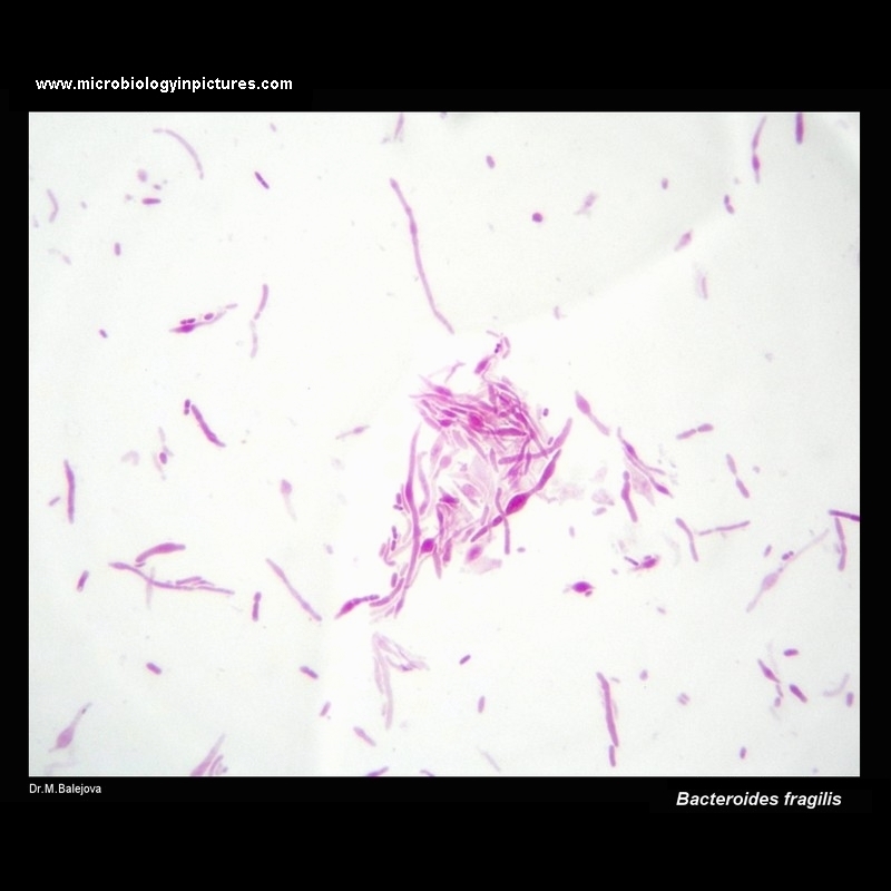 Bacteroides fragilis 