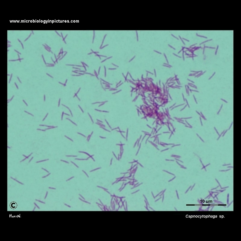 Capnocytophaga sp. light microscopy