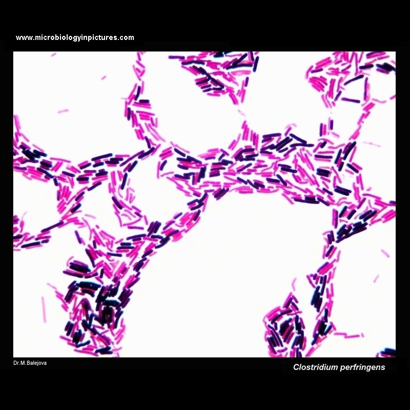 Clostridium perfringens microscopy