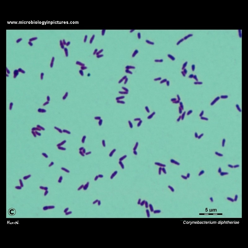 Corynebacterium diphtheriae light microscopy