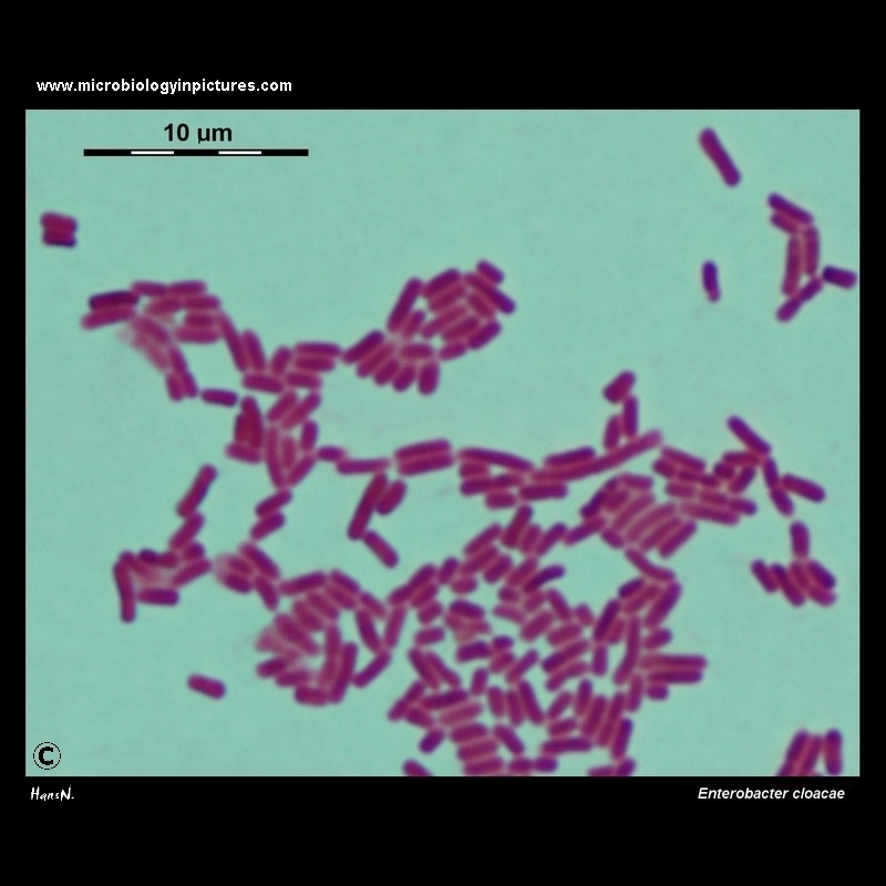 Enterobacter cloacae light microscopy