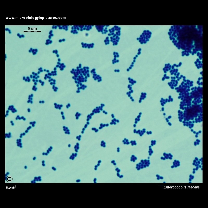 Enterococcus faecalis microscopy