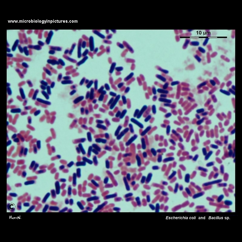Escherichia coli and Bacillus sp. microscopy