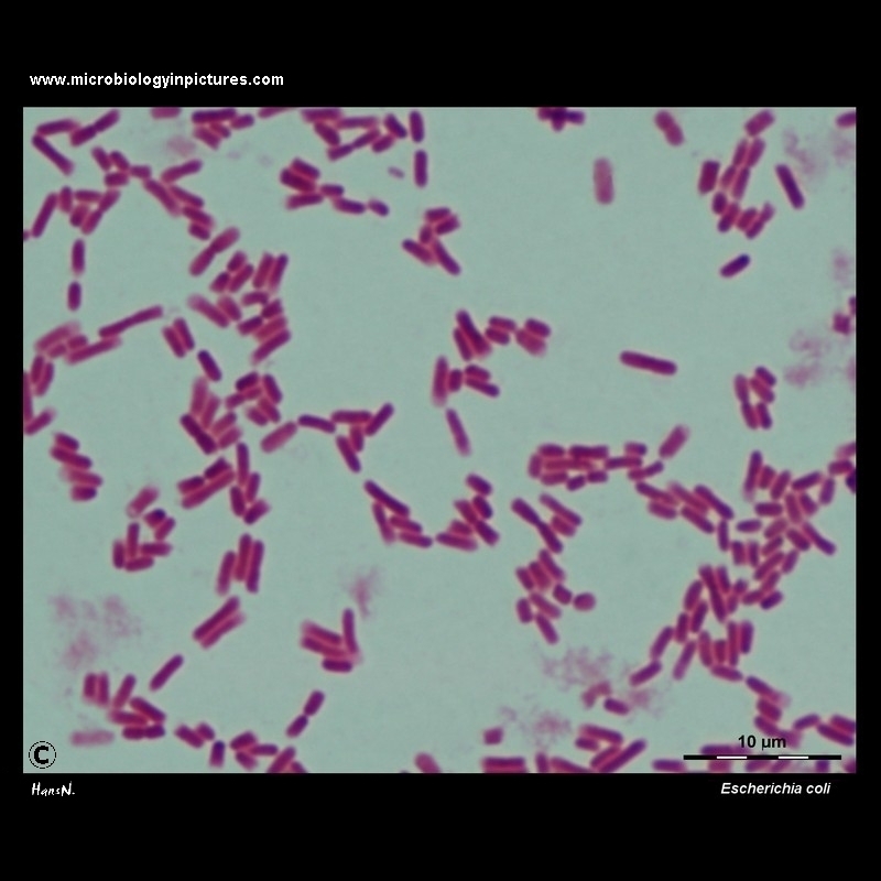 Escherichia coli light microscopy