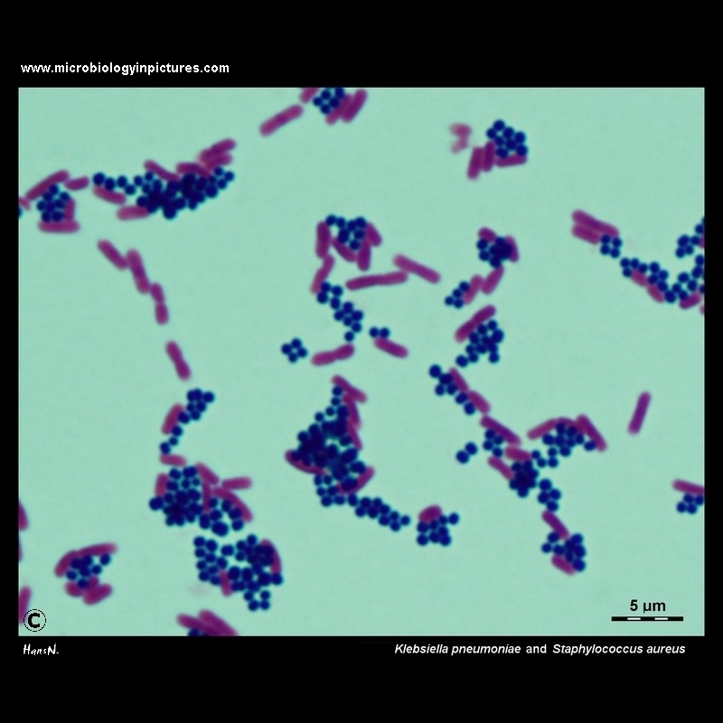 Klebsiella pneumoniae and Staphylococcus aureus microscopy