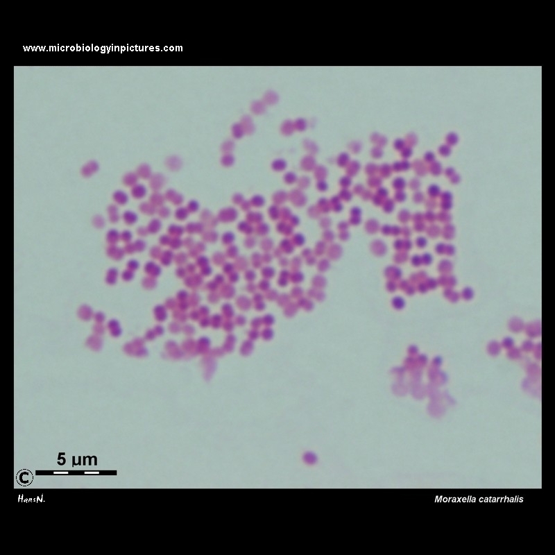 Moraxella catarrhalis light microscopy
