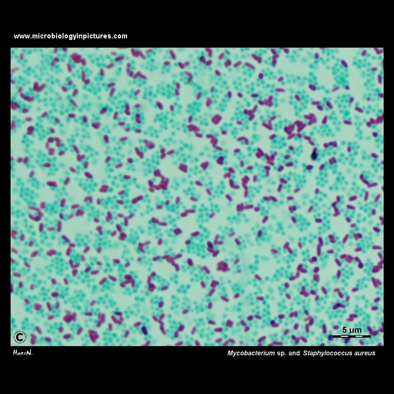 Mycobacterium sp. and Staphylococcus aureus microscopy