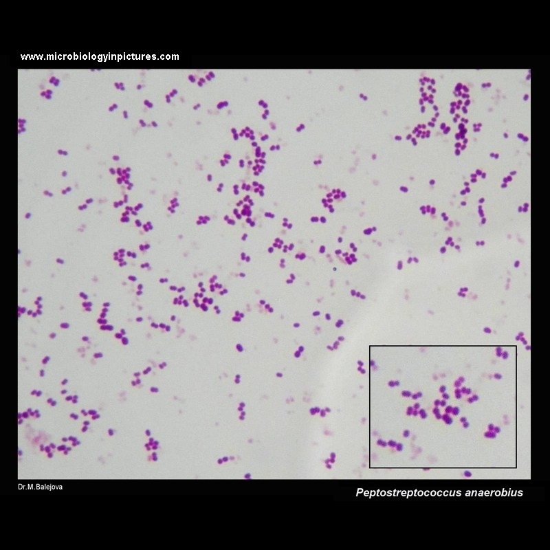 Peptostreptococcus anaerobius