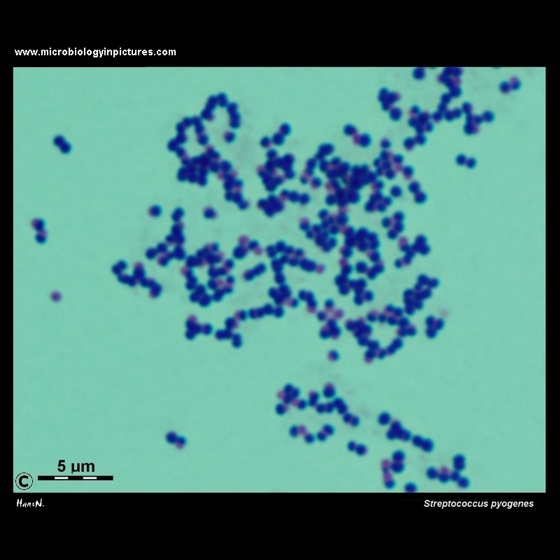 Streptococcus pyogenes microscopy