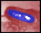 Listeria monocytogenes on blood agar