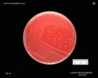 listeria_monocytogenes