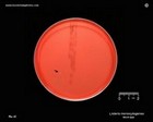 listeria_monocytogenes
