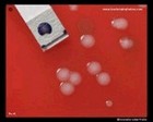 Moraxella catarrhalis oxidase test