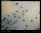 MRSA