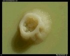fast growing mycobacterium