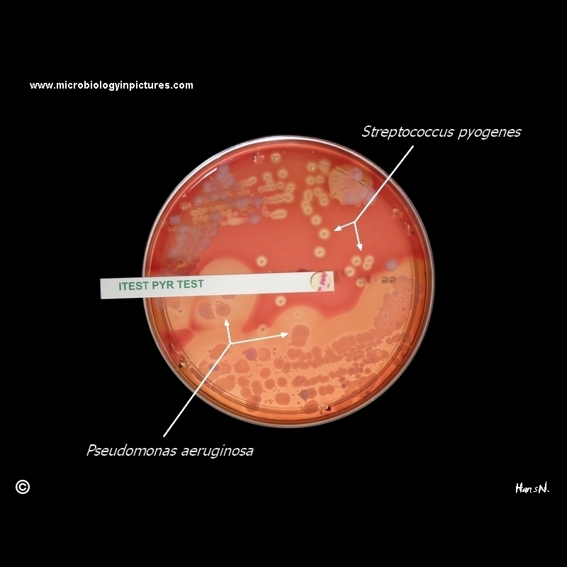Streptococcus pyogenes positive PYRase test