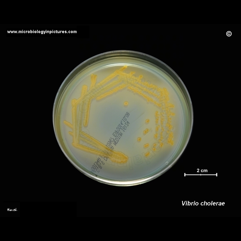 vibrio cholerae on TCBS