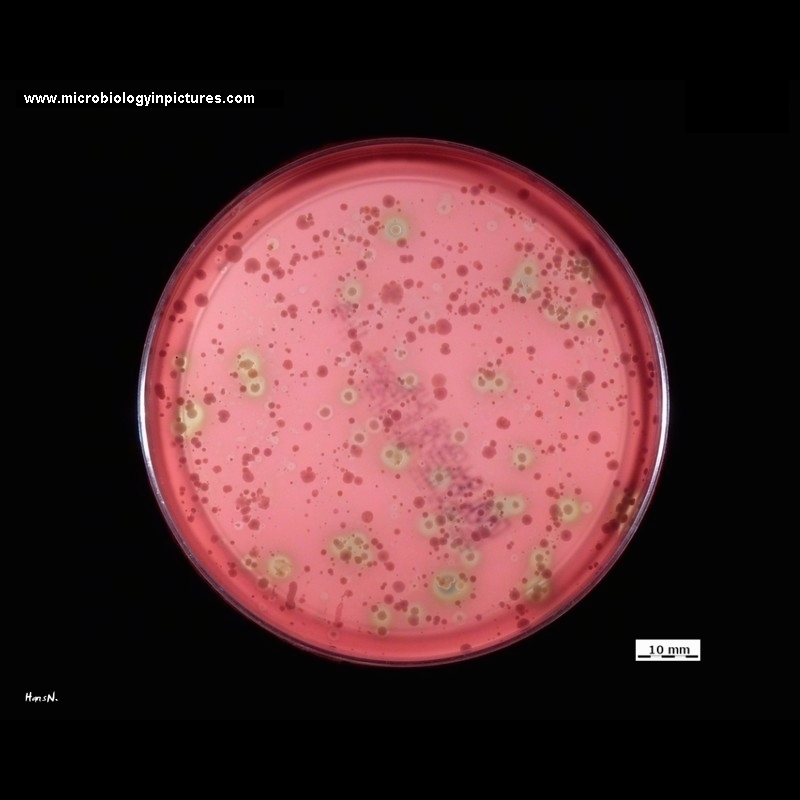 alpha and gamma hemolysis
