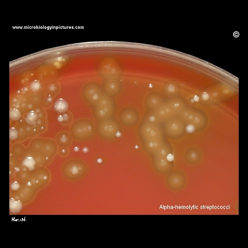 alpha (viridans) streptococci
