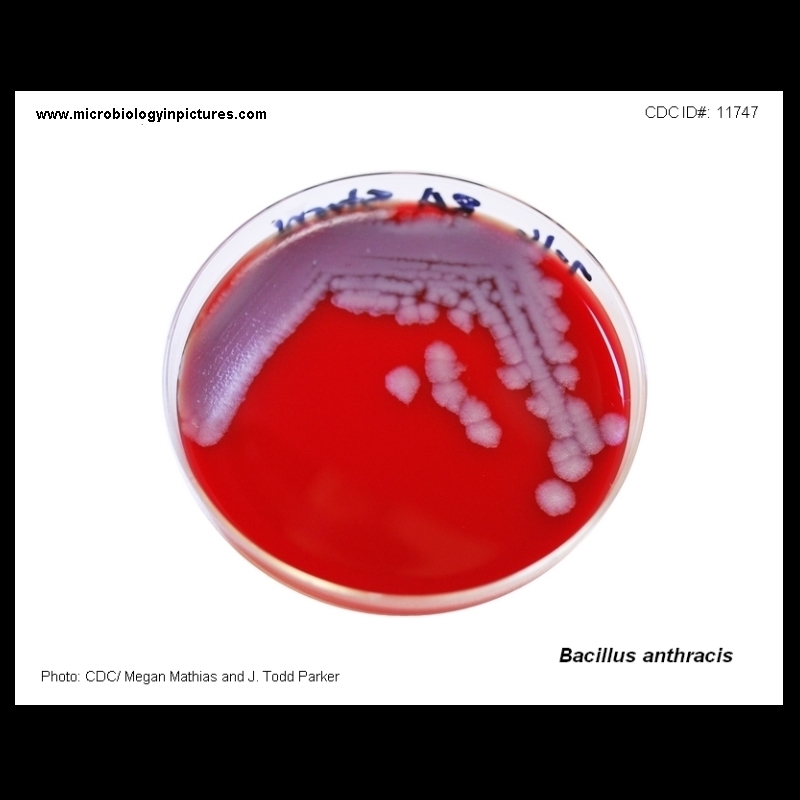 Bacillus anthracis