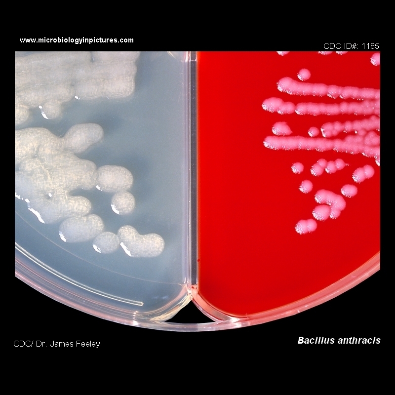 Bacillus anthracis appearance