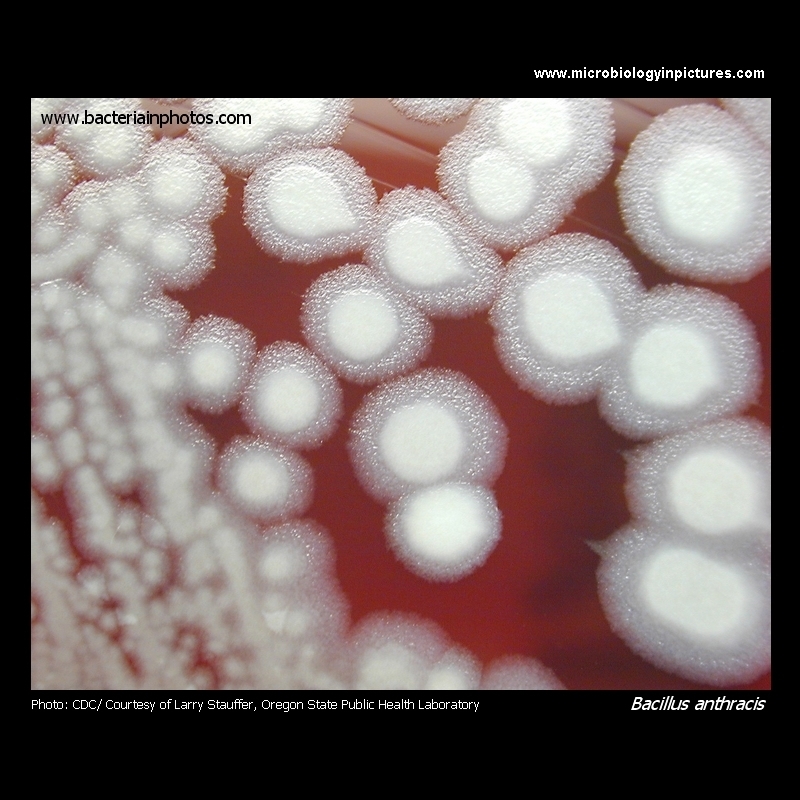 Bacillus anthracis colonies on blood agar