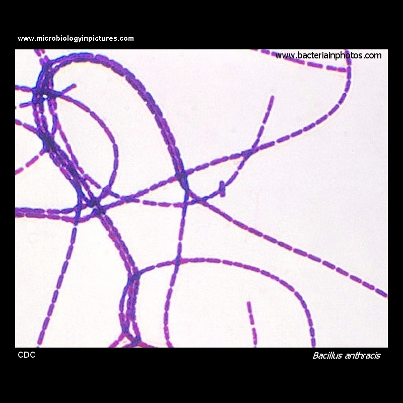 Bacillus anthracis micrograph