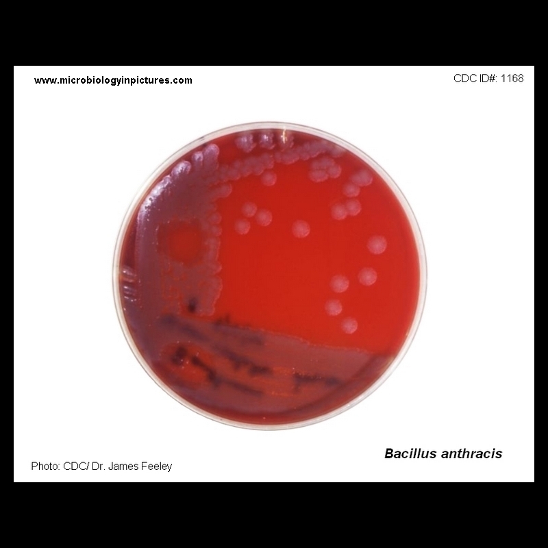 Bacillus anthracis on P.dish