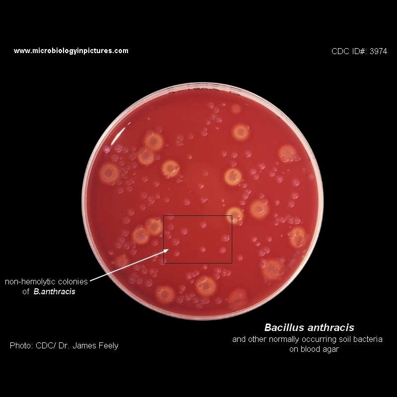Bacillus anthracis growth on blood agar