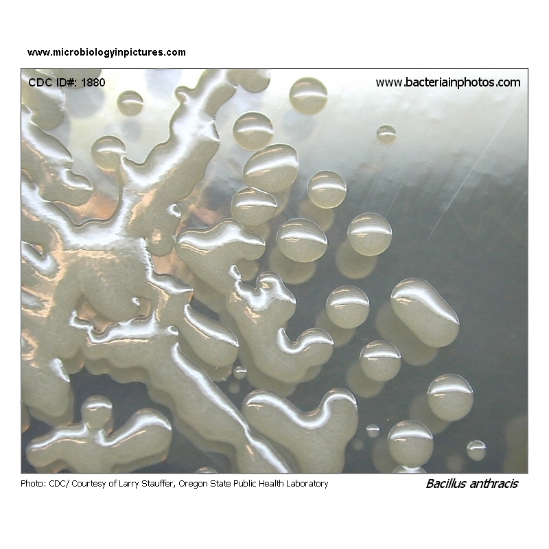 Bacillus anthracis capsule
