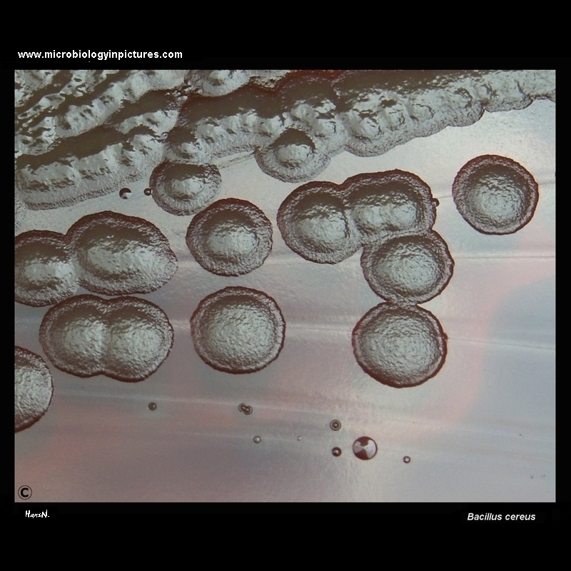 Bacillus cereus colonies on blood agar