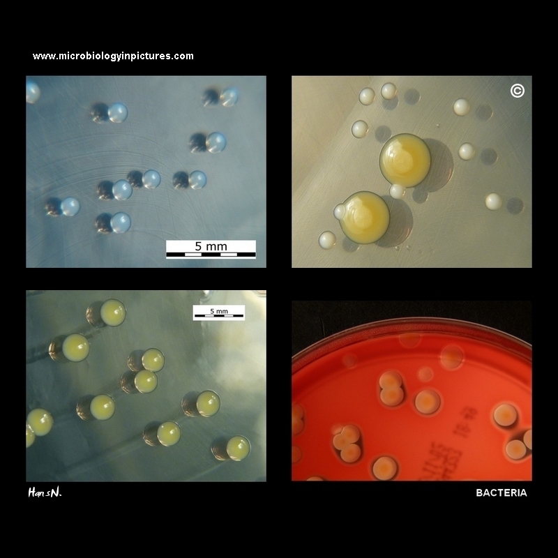 bacteria images with description