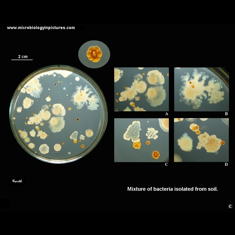 bacteria on agar plate