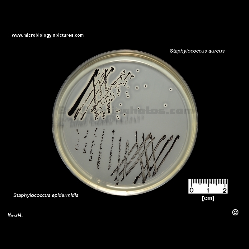 staphylococcus on baird parker agar.jpg