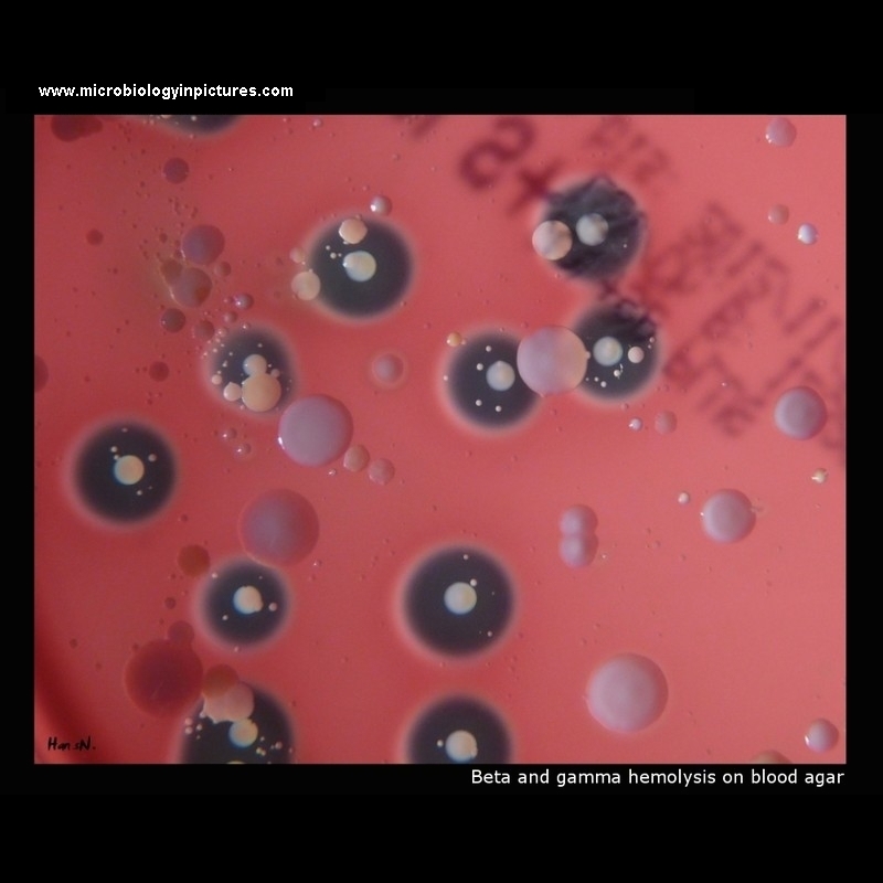 beta and gamma hemolysis on blood agar